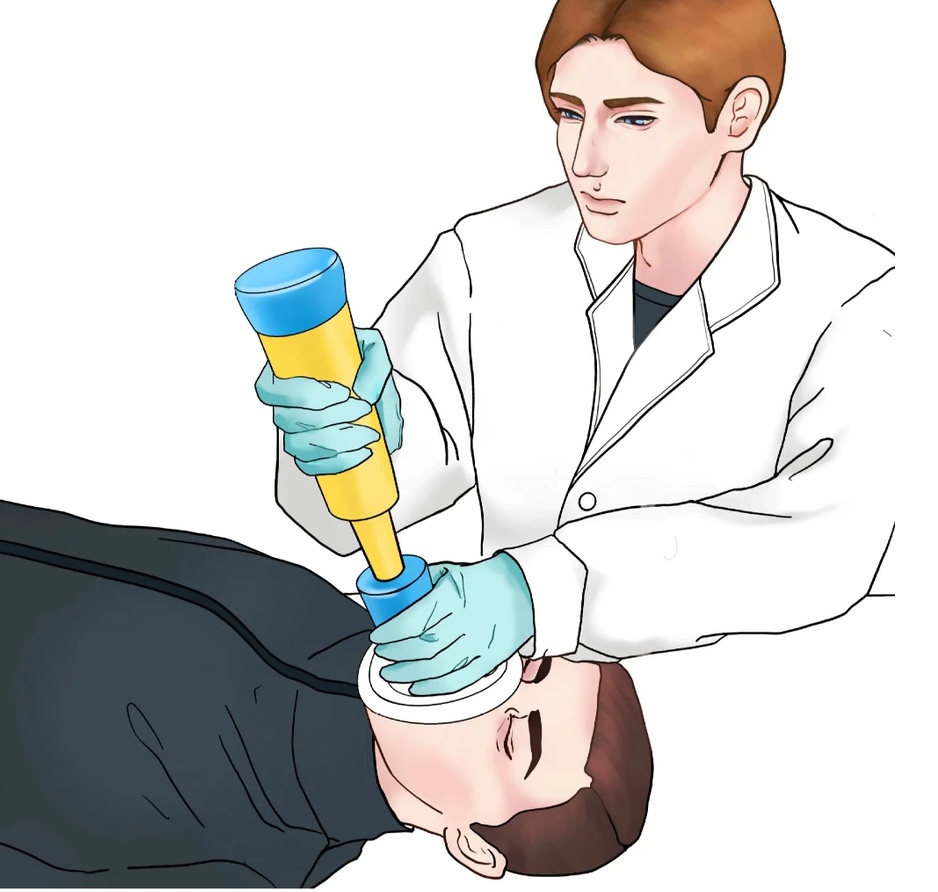 Choking Rescue Device for Kids and Adults with 2 Masks (Portable)